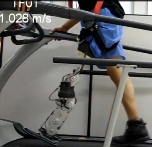 Bionic Locomotion, Robotic-Leg, Prosthetic, Amputees, Walk Normally, Cyborg, Future Medicine, Health, Cyberpunk, Augmentation