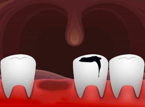 Regenerative Medicine, Could Humans Ever Regrow Teeth? The Future of Medicine